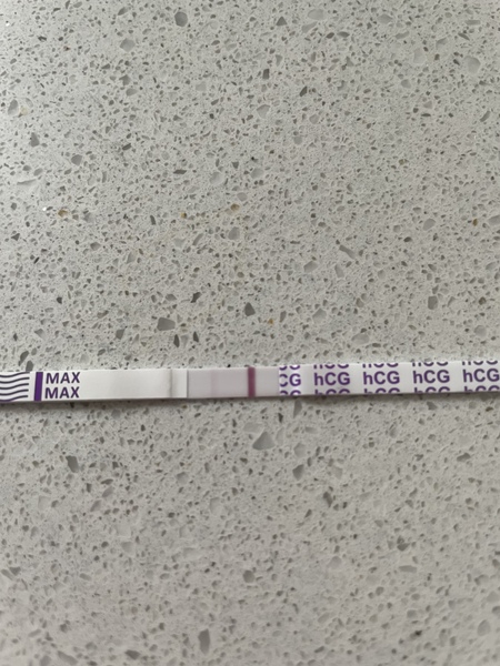 Ectopic pregnancy