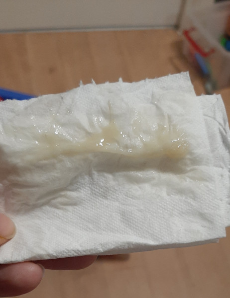 **PIC TMI** Is this my mucus plug?