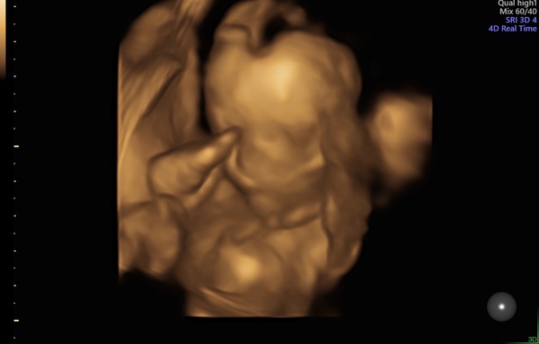 Due September 2022 (Thread 6!)