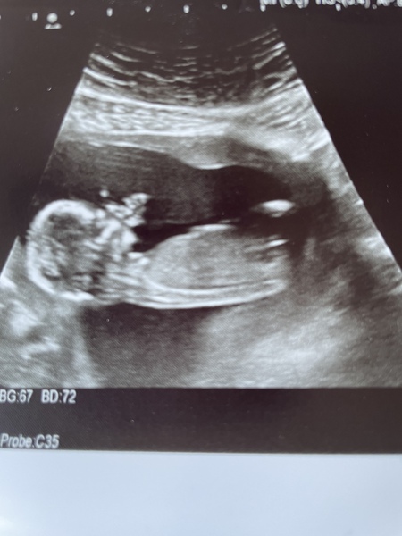 Gender guess, nub experts please