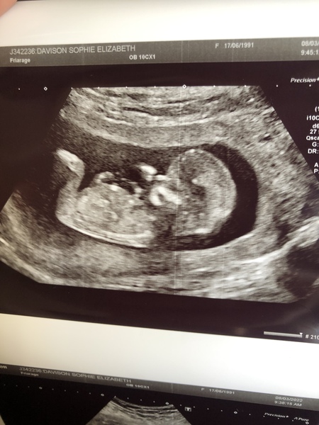 Boy or girl guesses