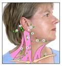 Little lump behind ear