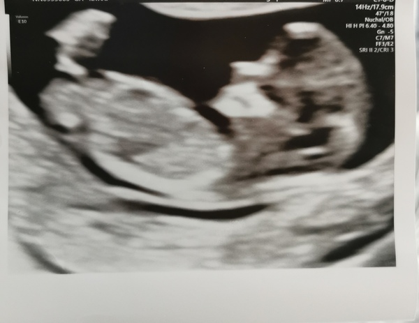 Due October 2022 thread #2 ... the first trimester continues!