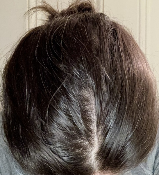 How much grey (hair) do you have?