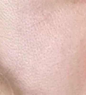 Blackhead help.please