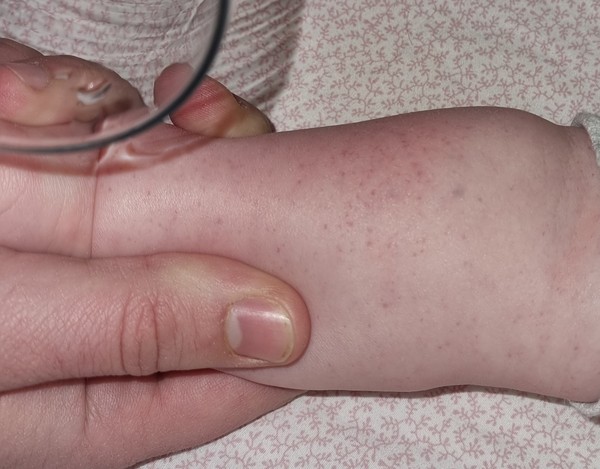 What could this rash be?