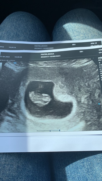 Navigating pregnancy after loss thread 2