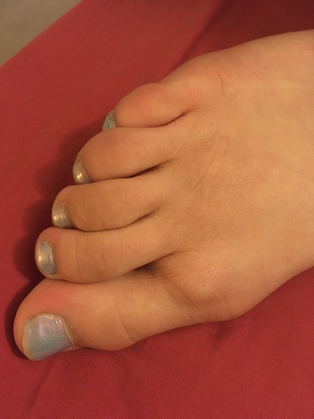 What’s this on DD’s toe? (pic)