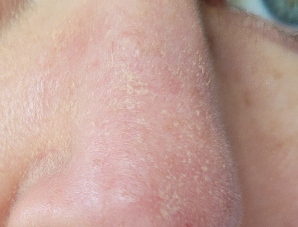 Why is my foundation doing this?!