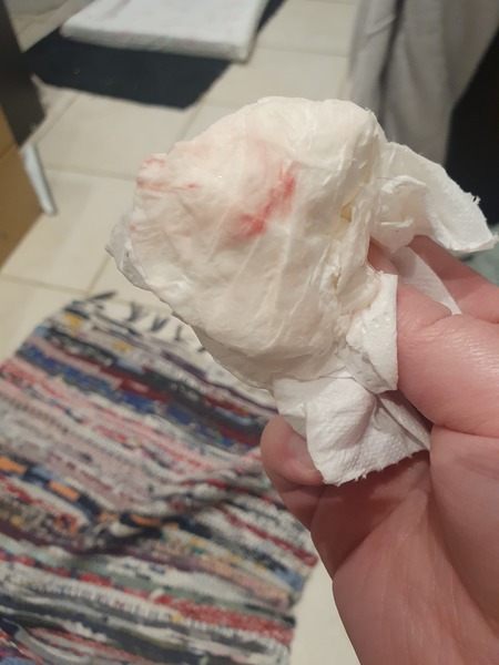 7dpo spotting? Pic included