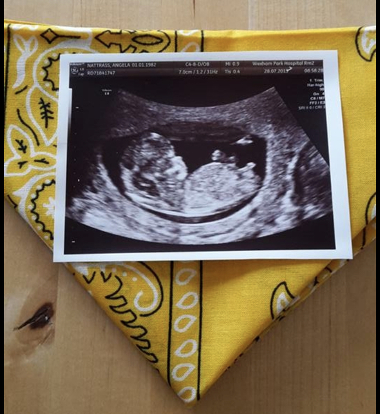 Anyone want to guess my baby’s gender from scan pic?