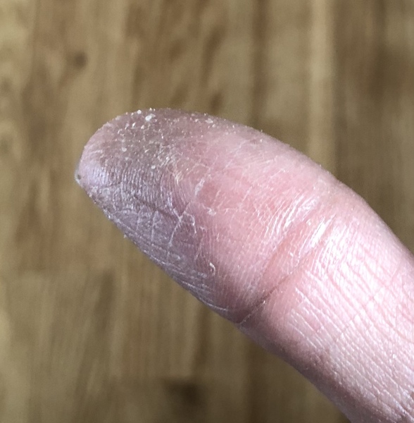 Rough hands