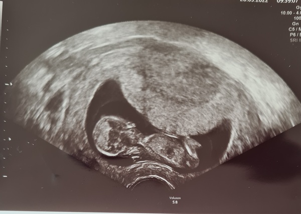 Show me you 12w scan. Am bored and want to test my nub theory 😁