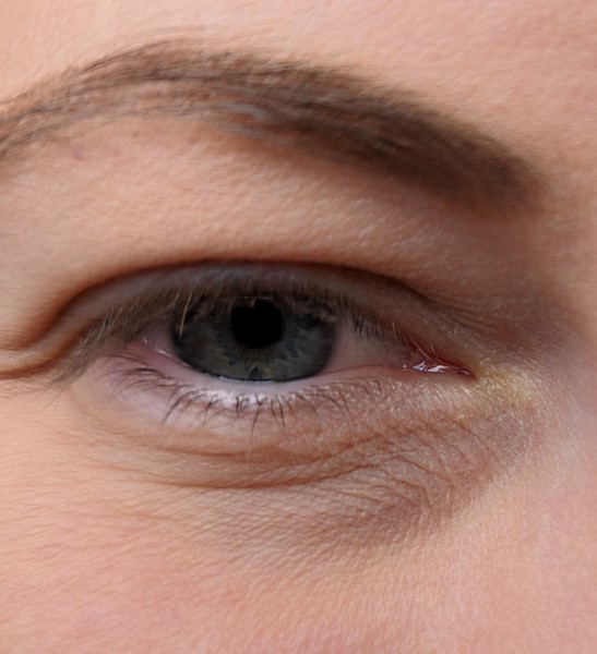 Eye cream recommendations? I'm 34. Help!