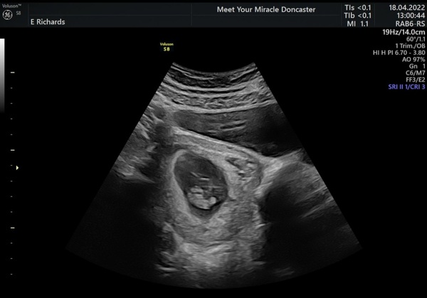 Due December (thread 2) 👯