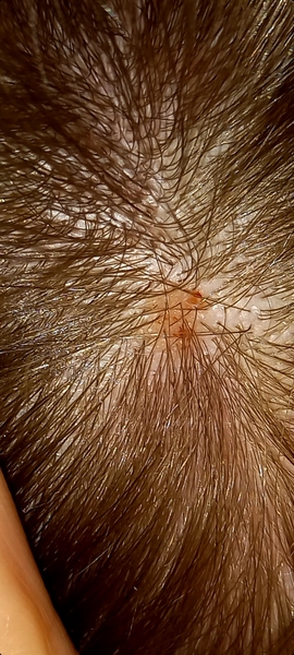 Suspicious mole...best place to get it checked out?