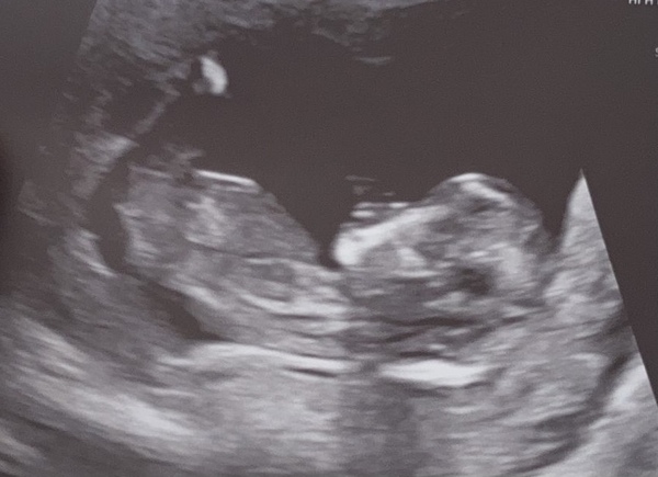 Due late Oct 🎃 - early Nov 🎉
