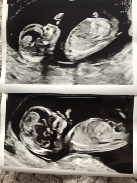 What’s your gender guess?