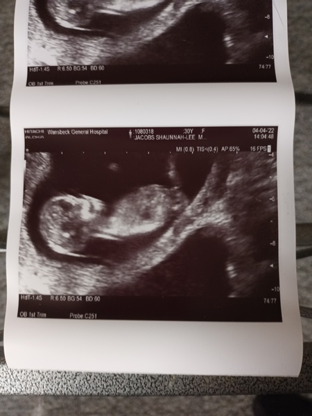 Skull theory anyone? Pics included