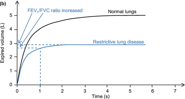 Any asthma knowledge/experience please?