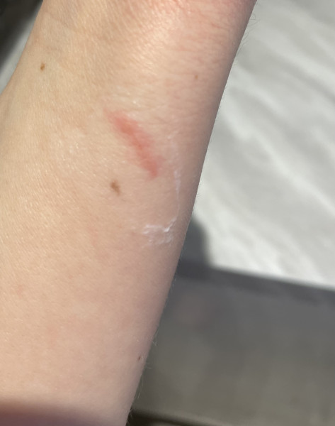 Does this look infected? 