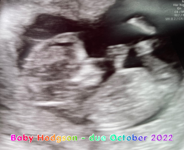 Navigating pregnancy after loss thread 2