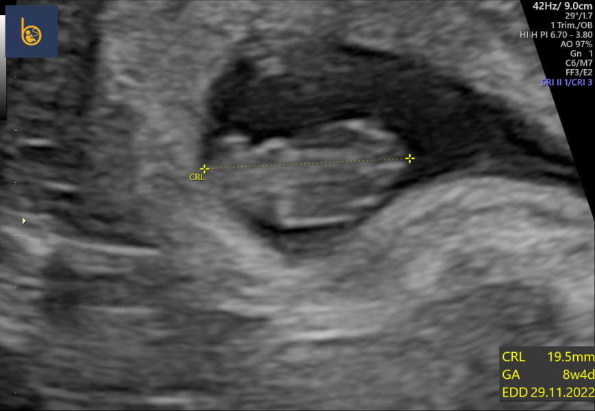 Due December (thread 2) 👯