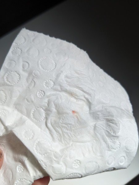 Can't be implantation bleeding??