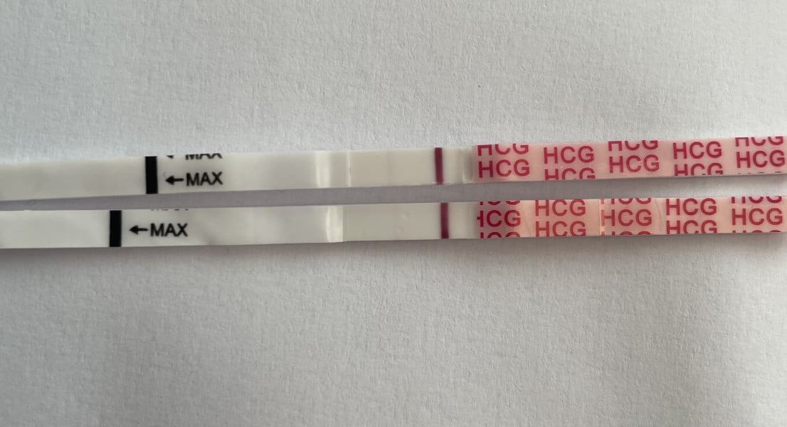 CD33 faint + one step 