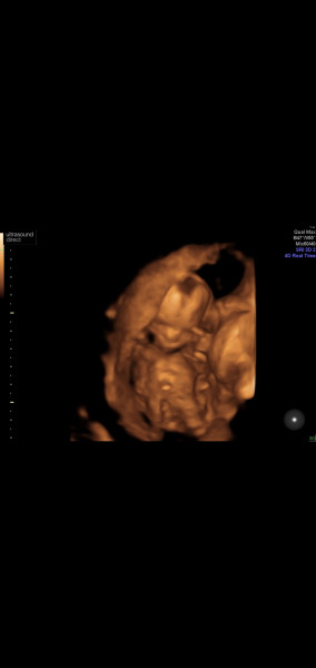 Due October 2022 thread #2 ... the first trimester continues!