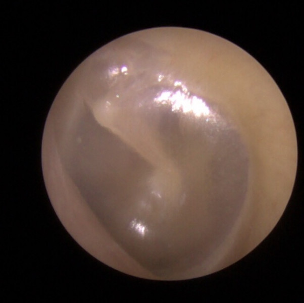 I’ve just had the ear wax lady out to visit…