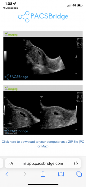 4+6 scan picture