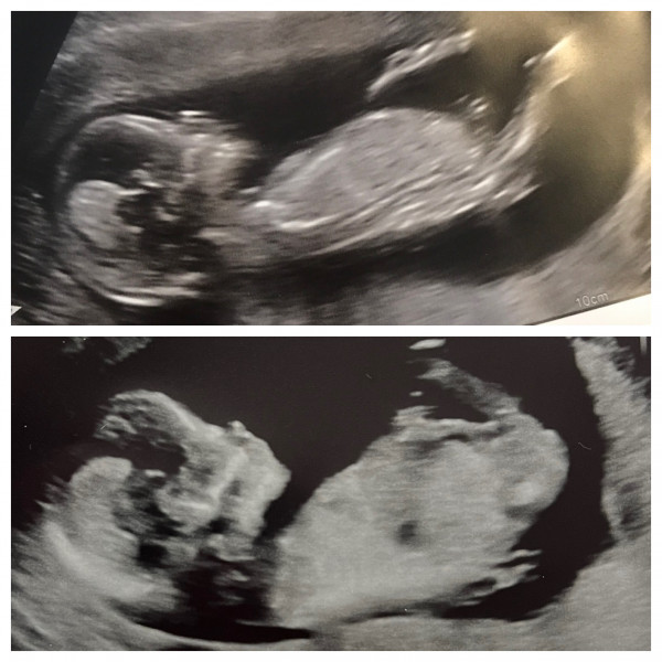 Skull theory gender guesses?