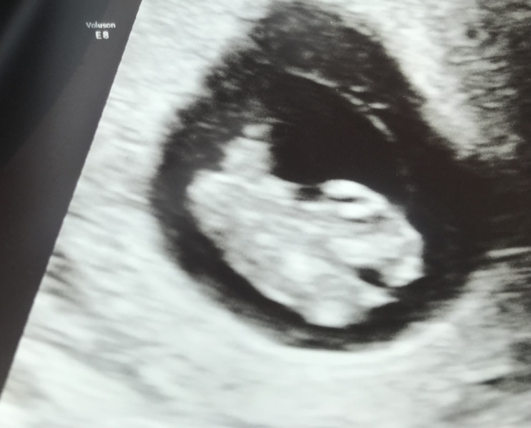 Due December '22 thread 2!