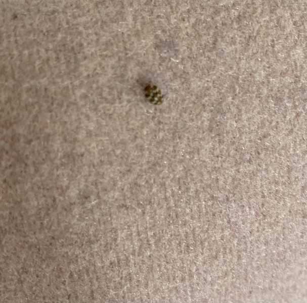 To burn down my house?
