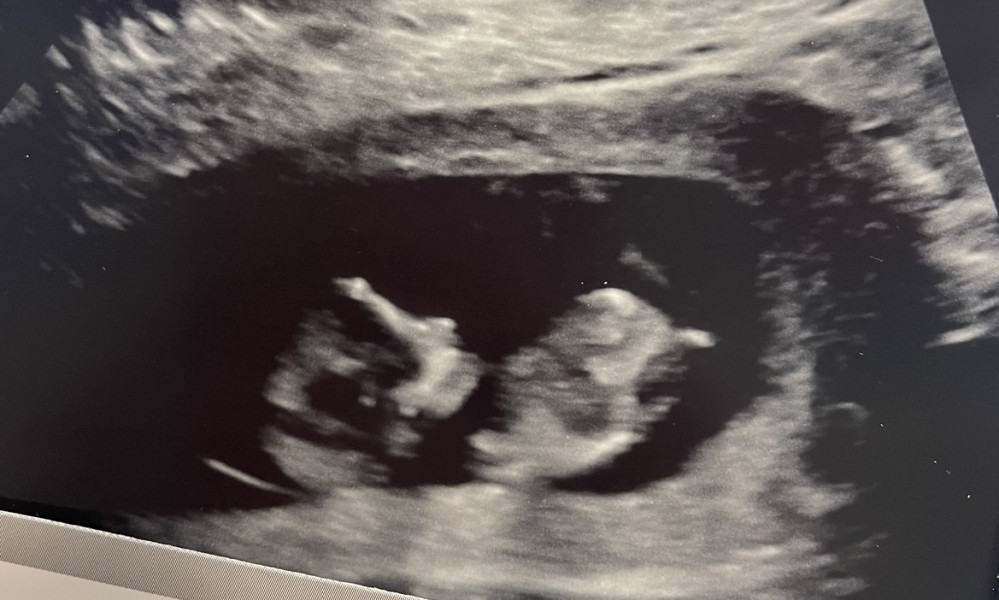 Navigating pregnancy after loss thread 2