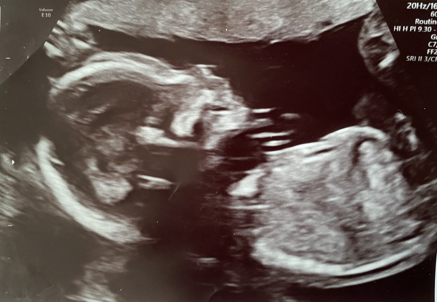Due September 2022 (Thread 6!)