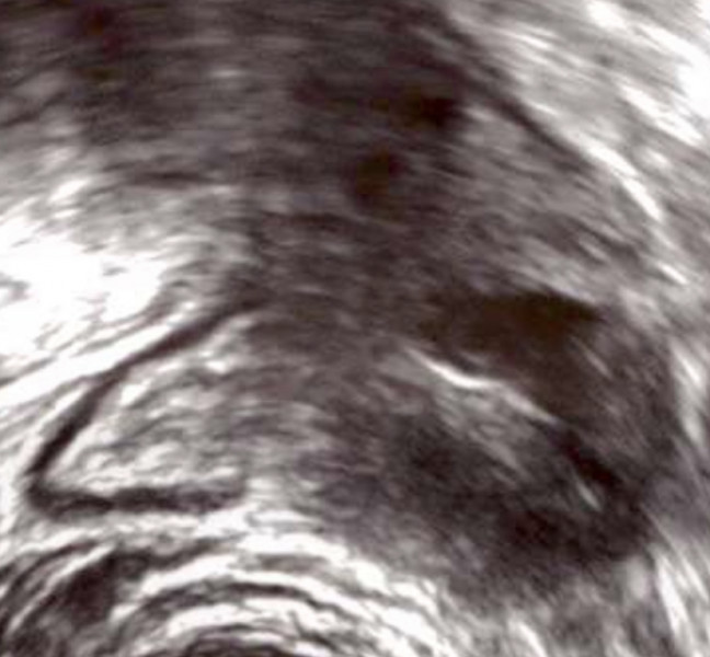 9 months+ trying to conceive, still losing hope, still trying