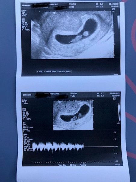 Due December '22 thread 2!