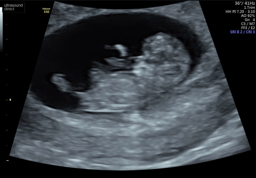 Gender guesses