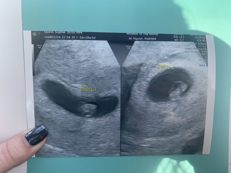 Due December (thread 2) 👯