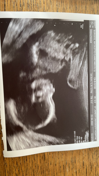 Due September 2022 (Thread 6!)