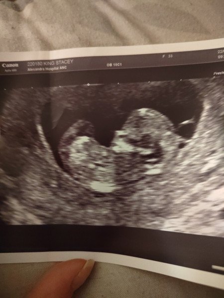 Boy or girl? 
