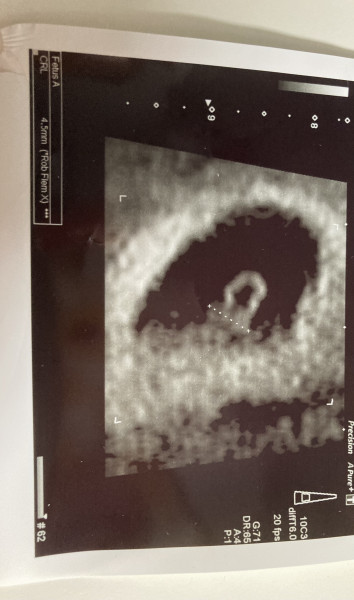 Due December (thread 2) 👯