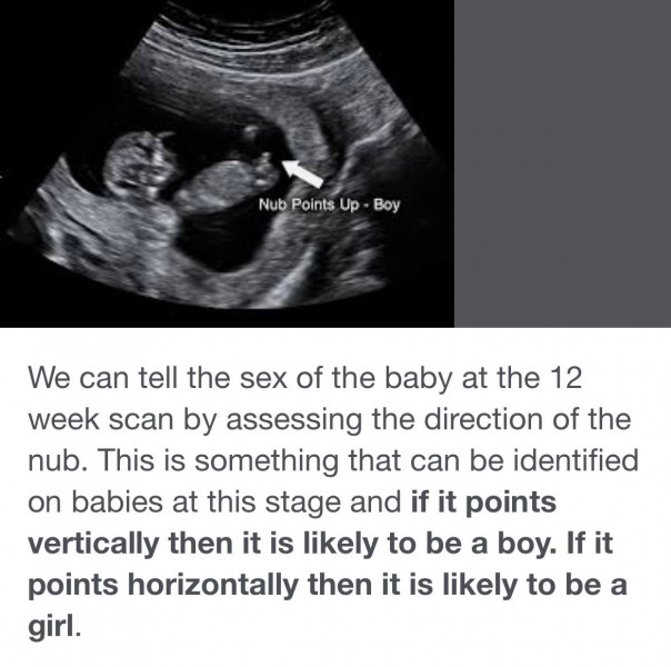 Navigating pregnancy after loss thread 2