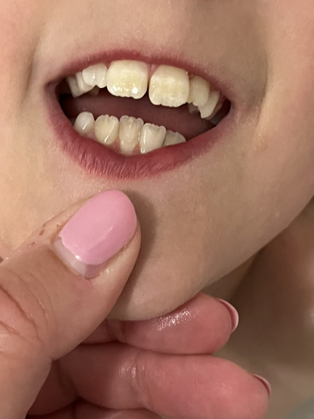 Any dentists? Pic included!