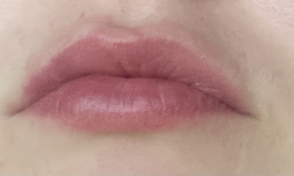 Swollen lips ? Advice please. 