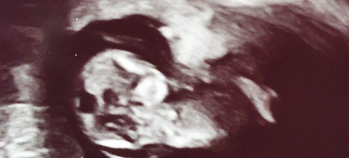 Navigating pregnancy after loss thread 2