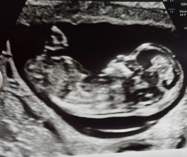 Navigating pregnancy after loss thread 2