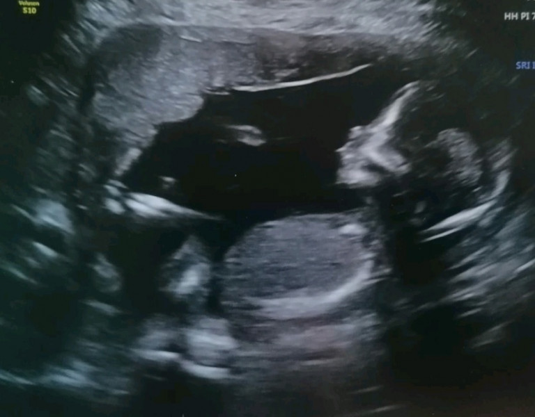 Boy or girl? 